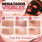 Máscara facial LED con Terapia de Luz para la Cara y la Piel